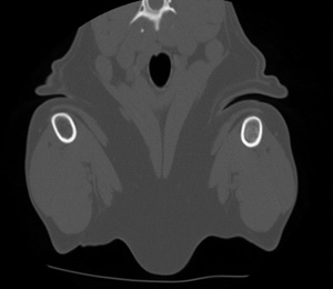 ct_forelimbs