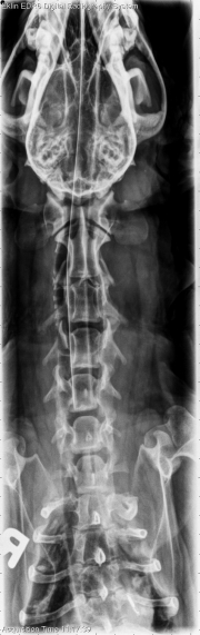 VD Spine